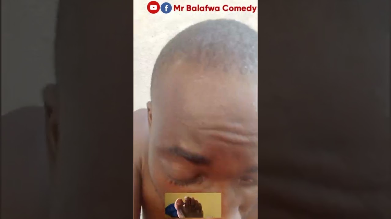 mr Balafwa is planning to sell his toes to Zimbabwe 🤣