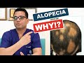 What is alopecia areata  causes diagnosis  hair regrowth treatments skinqure in hindi