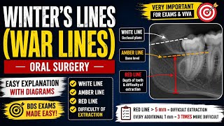Part-2 Winter's lines(WAR Lines)|Oral Surgery|Impacted third molar|BDS Exam 