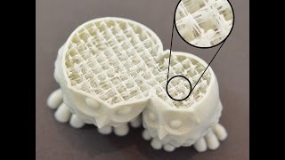 中埋めの線が細すぎる病　Simplify3D QualityTroubleshooting Japanese Translation 日本語翻訳18