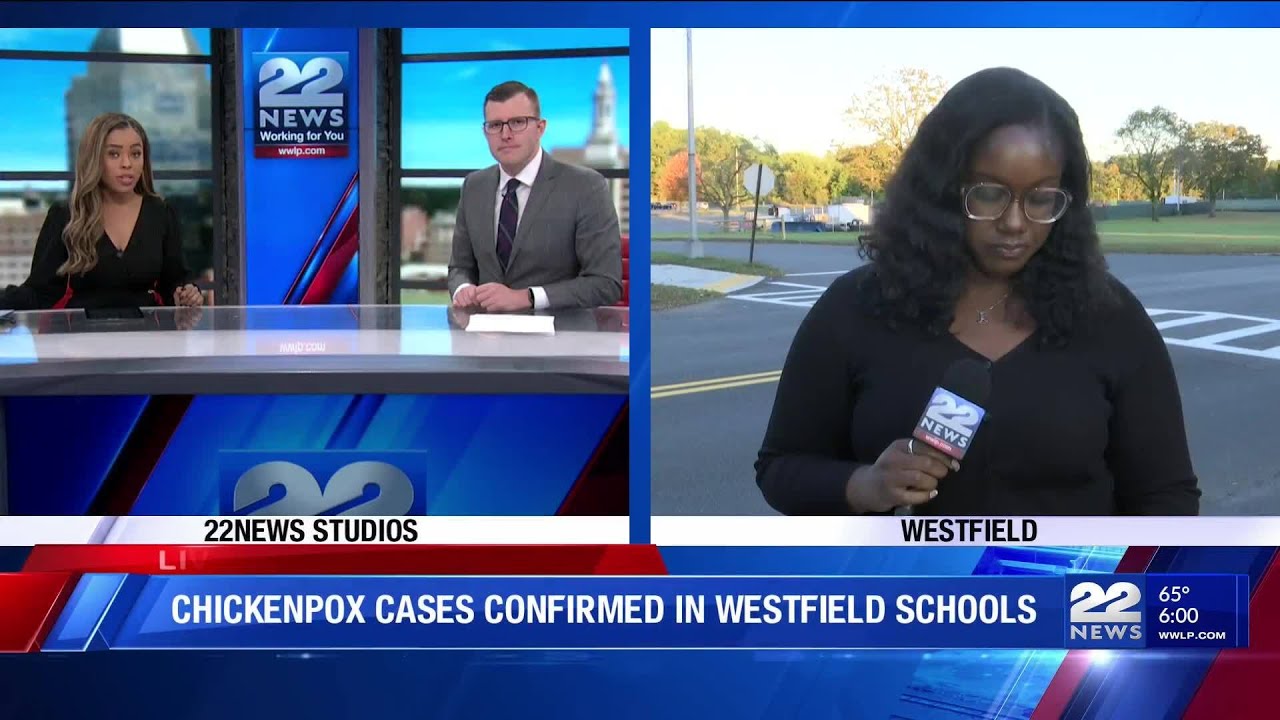 Chicken pox outbreak hits Westfield Public Schools