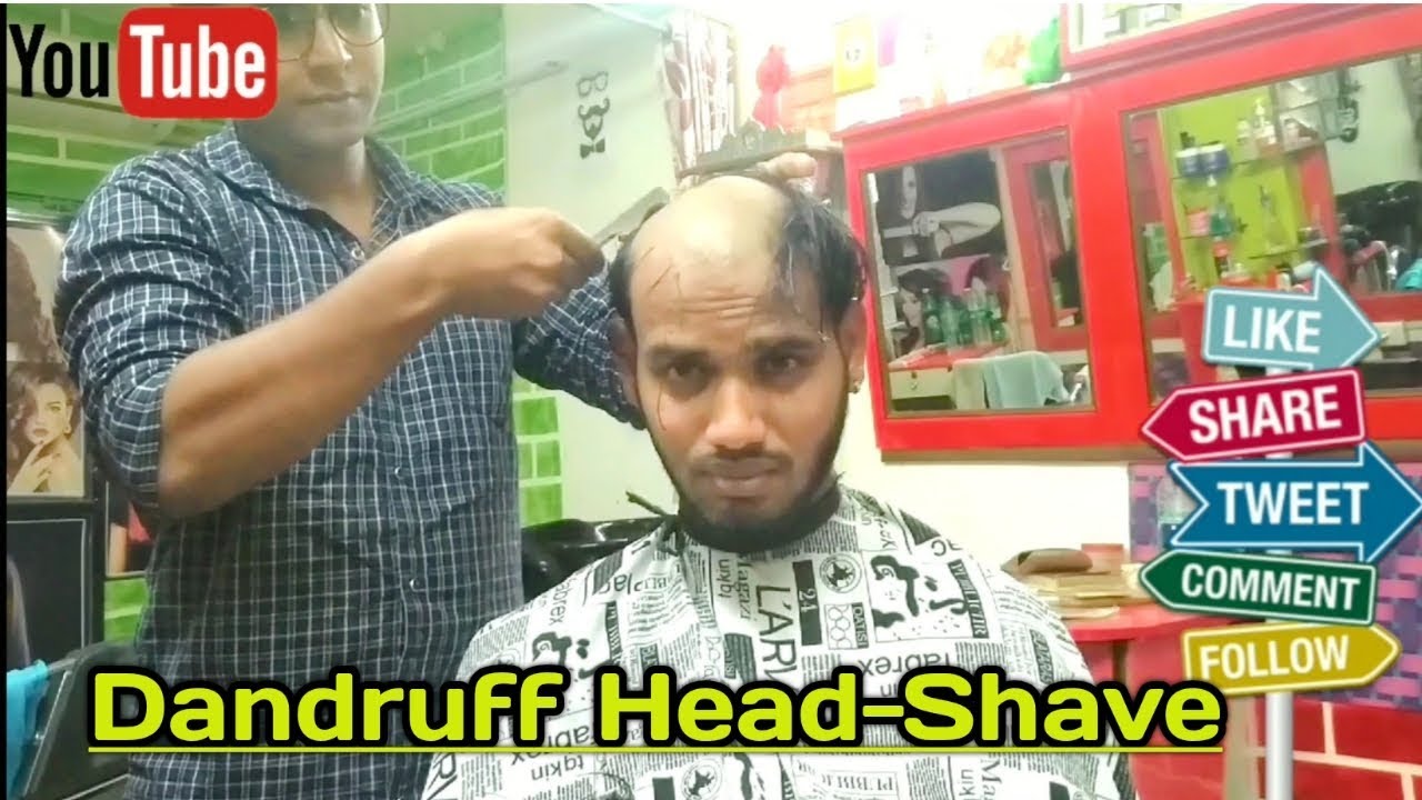 Headshave / How to Dandruff Head Shave / Dandruff Removal Headshave