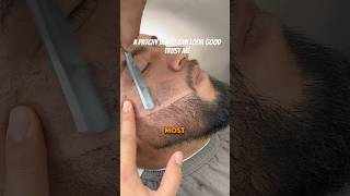 A Patchy Beard Can Look Good Trust Me