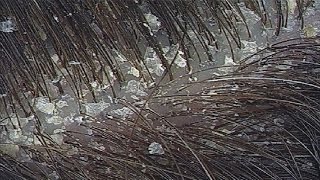 МАСКИ ДЛЯ ВОЛОС РОСТ ПЕРХОТЬ ВЫПАДЕНИЕ МАСКИ ДЛЯ ВОЛОС РОСТ ПЕРХОТЬ ВЫПАДЕНИЕ