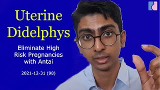 Uterine Didelphys & Treatment - Antai Hospitals