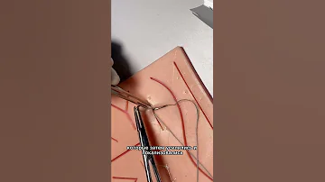 РАЗБОР ХИРУРГИЧЕСКОГО СЛУЧАЯ ОТ Scalpel.med ЧАСТЬ 1 - ТРЕНИРОВКА ХИРУРГИЧЕСКОГО ШВА