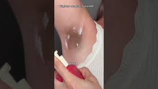 Brighter Armpits in 7 Days Real Results! ✨ | Skincare Routine