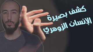 كشف بصيرة الإنسان الزوهري | الراقي أبو إيمان