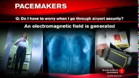 Pacemakers