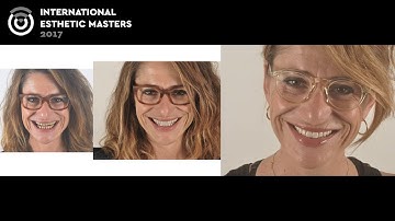 Repeatable and predictable protocol in the treatment of worn dentition