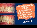 Эта опасность грозит пациентам со съёмными протезами на крючках. ДВНЧС.