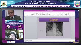 An Introduction to Pulmonary Imaging: How to Approach