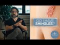How To Identify Shingles 