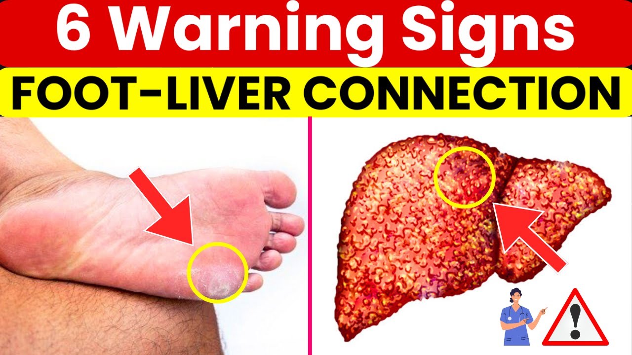 How Your Feet Are Warning You About Your Liver Problems | Health Tips