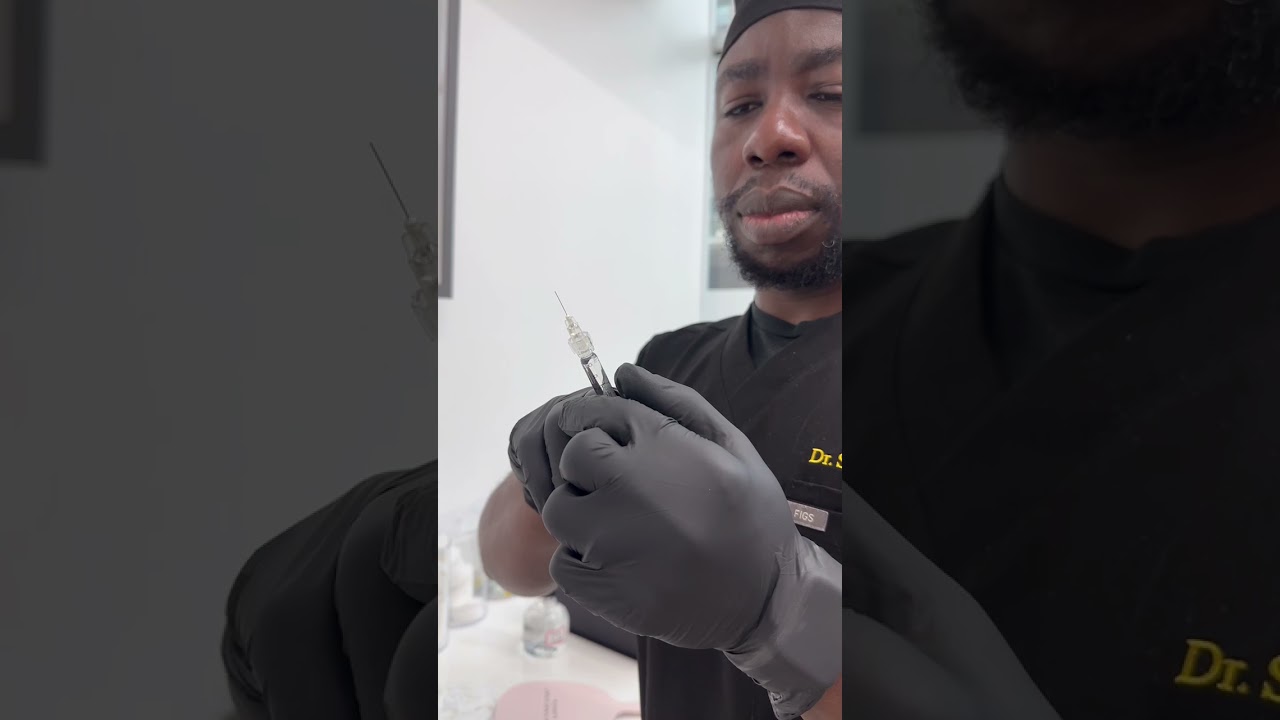 Lip Filler Treatment - Revanesse Lips