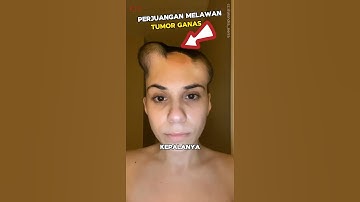Perjuangan Melawan Penyakit Mematikan‼️