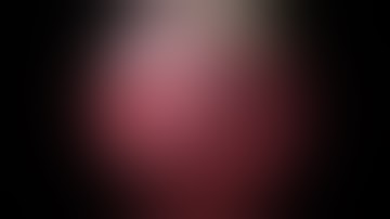 TURBT - Multiple Bladder Tumor , Dome 4 cm , Tips and Tricks