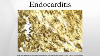 Endocarditis