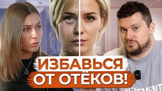 ЦЕЛЛЮЛИТ, ОТЕКИ, ПРЫЩИ и СЛАБЫЙ ИММУНИТЕТ! / Что такое ЗАСТОЙ лимфы и как его избежать?