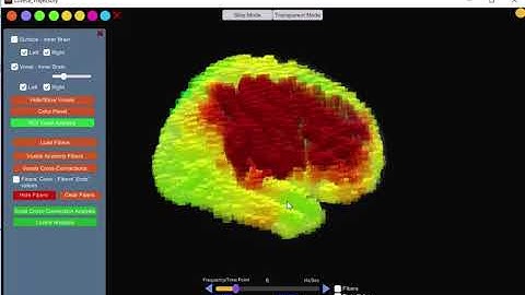 Neuroguide - Current Density