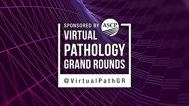 VPGR: Creepy Dreadful Wonderful Parasites