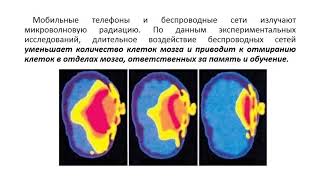 В чем опасность электромагнитных излучений? Кузнецова Юлия Вадимовна