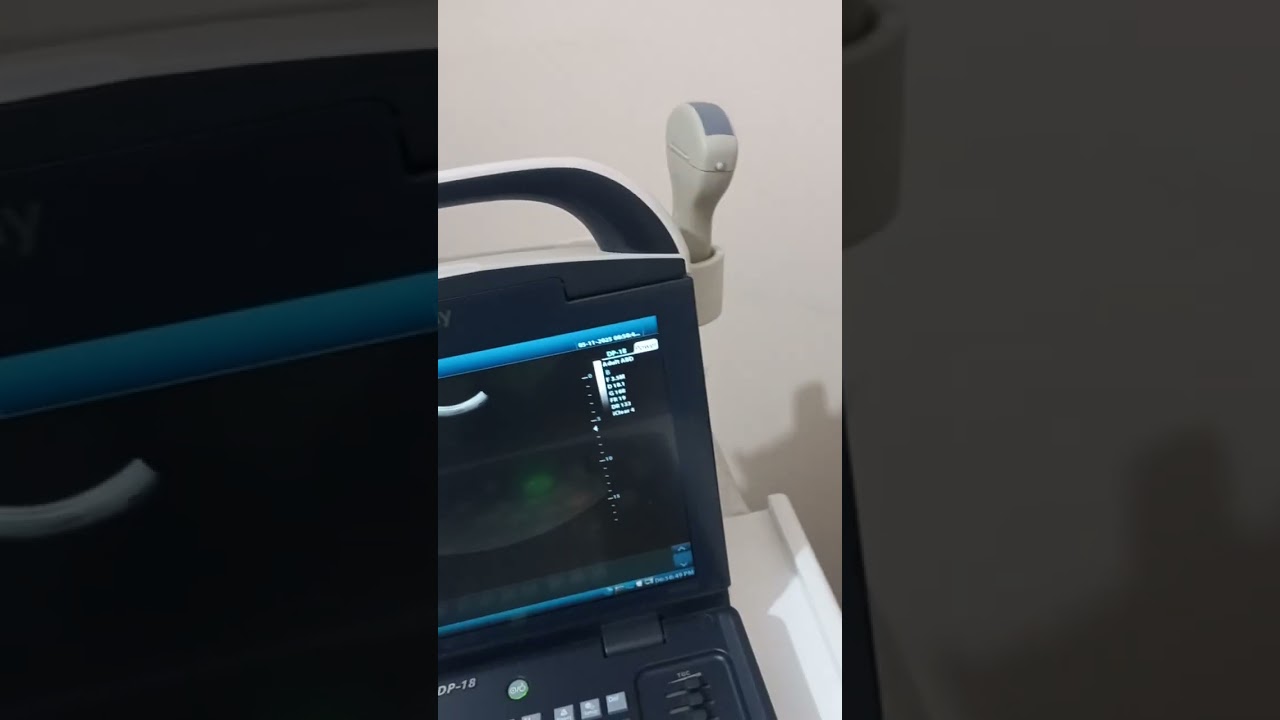 تعلم سونار العيادة ١