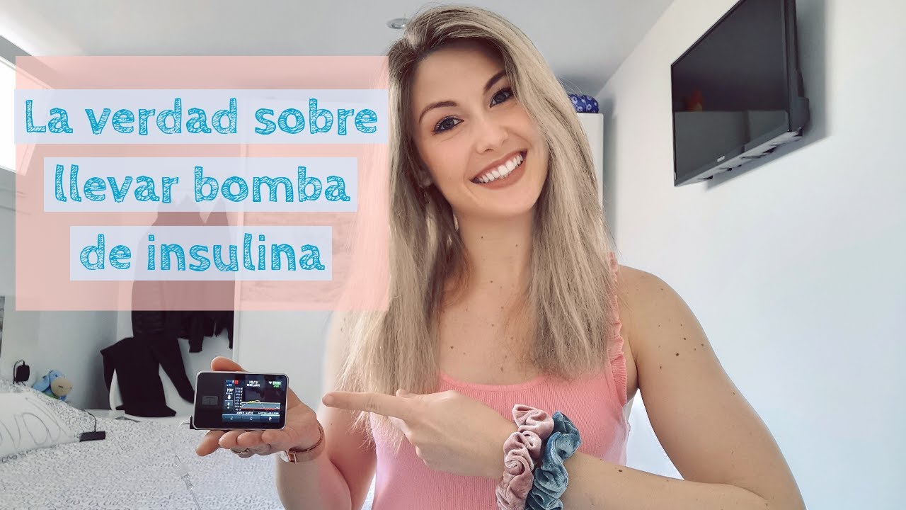 La verdad sobre llevar bomba de insulina