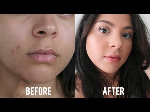 Flawless Face Routine | How To Cover Acne, Scars, Dark Spots, Etc.