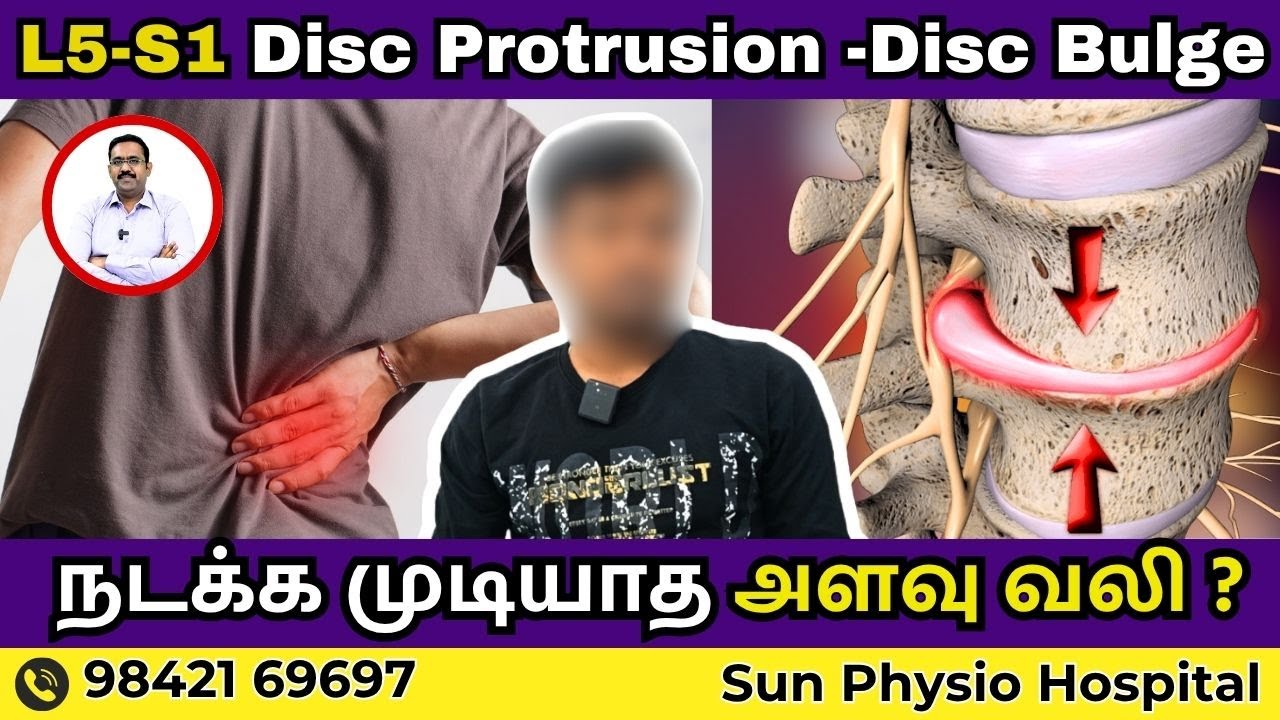 L5-S1 Disc Protrusion - நடக்க முடியாத அளவு வலி? சிறந்த சிகிச்சை & Exercises | Sun Physio Hospital .