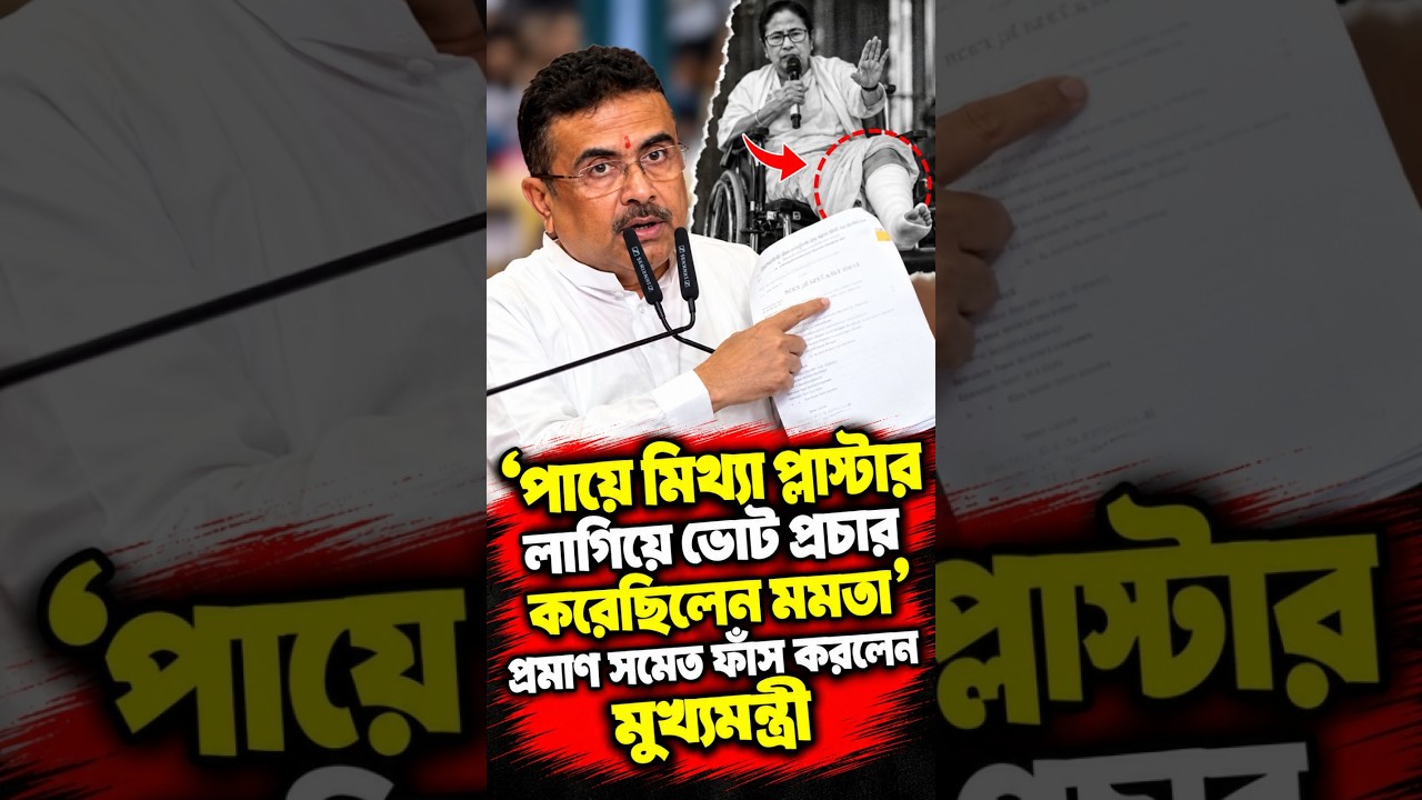 'পায়ে মিথ্যা প্লাস্টার লাগিয়ে ভোট প্রচার করেছিলেন মমতা' প্রমান সমেত ফাঁস করলেন মুখ্যমন্ত্রী