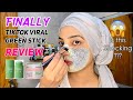 VIRAL GREEN STICK MASK WORKS or NOT??? TESTING OUT SHOCKING RESULTS