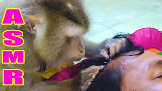 Scalp Raw Dandruff Most incredible ASMR Extraction Process | Dr. LYLY SUPPER EXTENDED​ Relaxing