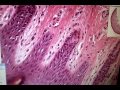 Histologia Pele Grossa Histologia Pele Grossa