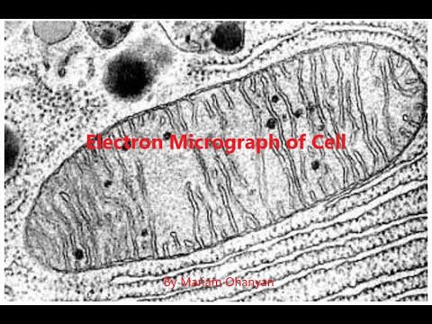 Electron Micrograph of Cell Organelles