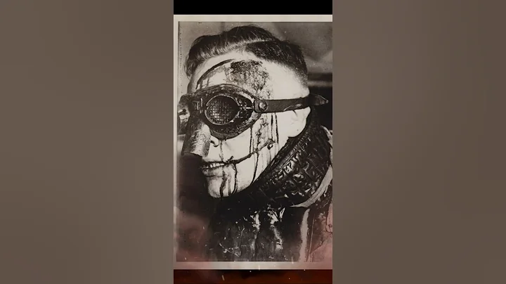 Why do so many German Officers have facial scars? #history #ww2