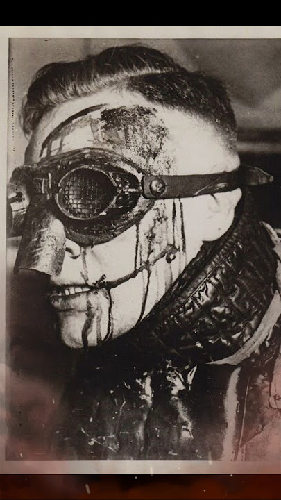 Why do so many German Officers have facial scars? #history #ww2
