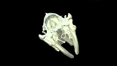 Linpol Luke skull fracture