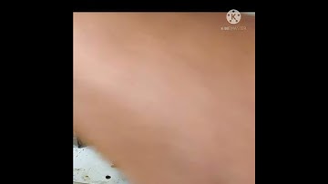 Redmi Note 4 Blue Display Solution 👍👍