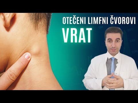 Što znače OTEČENI LIMFNI ČVOROVI U VRATU? I kada se trebate zabrinuti ...