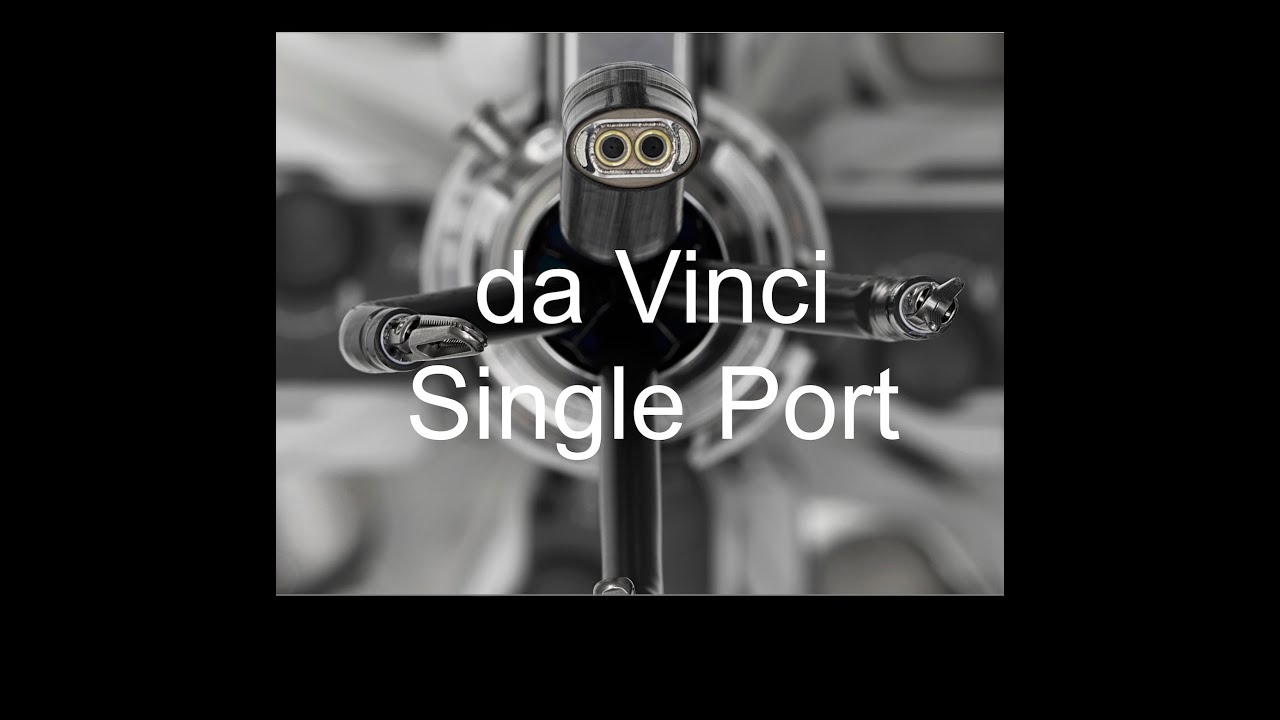 da Vinci SP Surgical System: Revolutionizing Single-Port Surgery