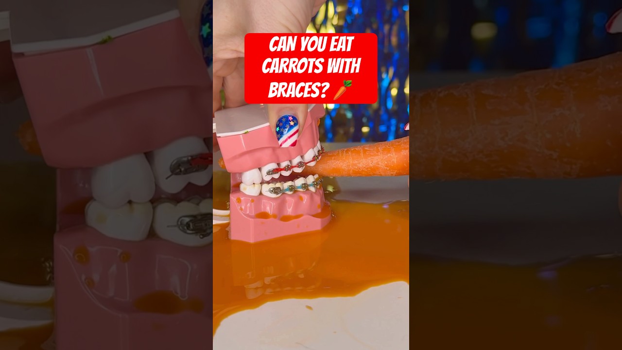 CAN YOU EAT CARROTS WITH BRACES? 🥕 