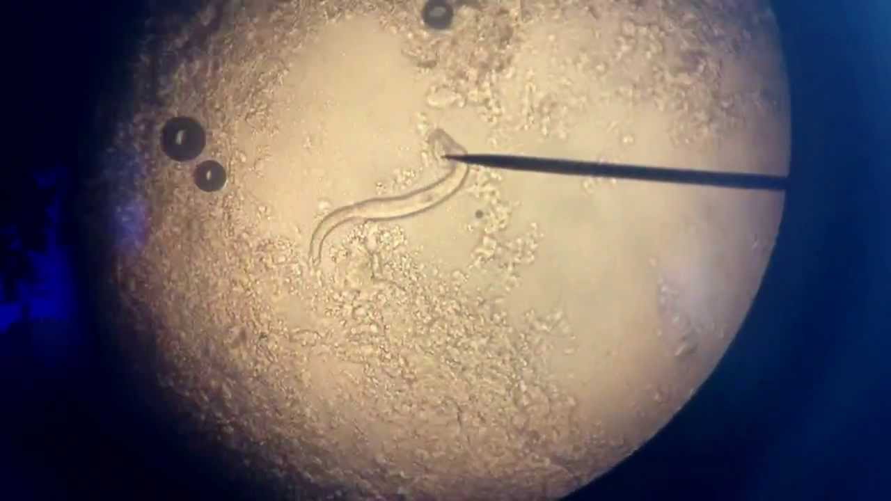 Gill Fluke Parasite Found On Koi 400 Time Magnification YouTube gill-fluke-parasite-found-on-koi-400-time-magnification-youtube