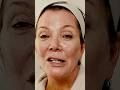 What Happened To Kris Jenner's Face?