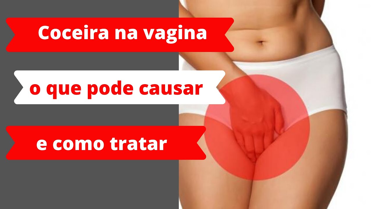 💢COCEIRA NA VAGINA - O QUE PODE CAUSAR, E O QUE FAZER PARA MELHORAR ...