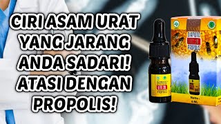 PROPOLIS DIAMOND LITE | CIRI CIRI PENYAKIT ASAM URAT APA SAJA KAH ITU?