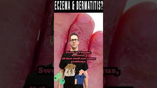 Dermatitis & Eczema: Dry, Itchy Skin or Rash not Better