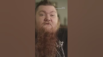 Căn bệnh khiến người phụ nữ có bộ râu dài nhất thế giới