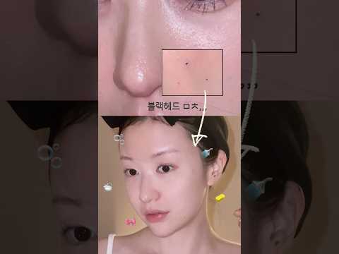 내 코에 이런게 박혀있었다니,, 오돌토돌 개기름 <strong>여드름</strong> 피부. 매끈매끈 광나는 <strong>세안법</strong> 🚿🧽