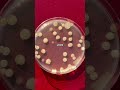 Bacteria Test on COINS 🪙💀